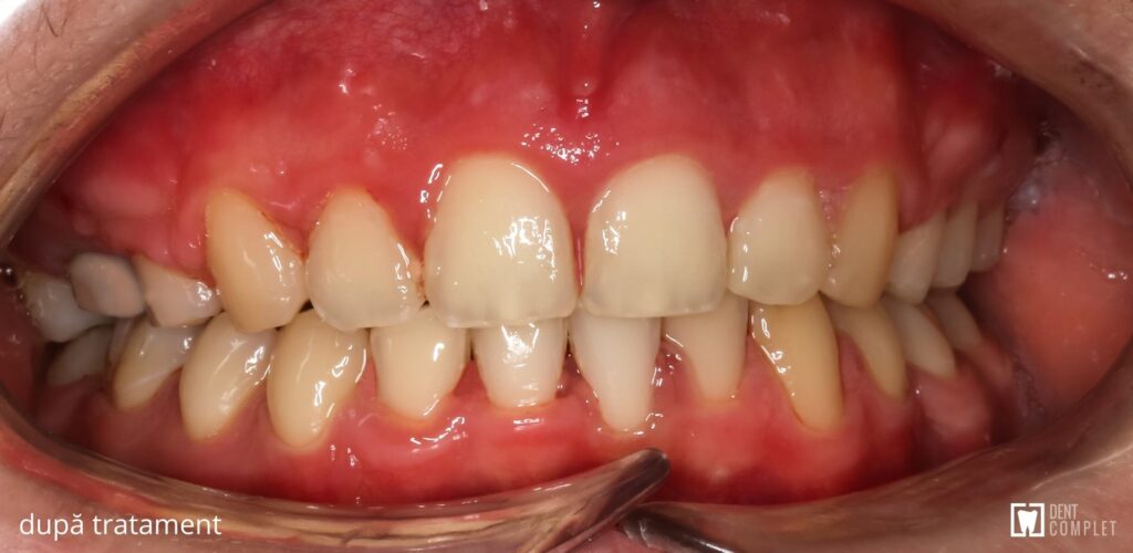caz clinic dent complet