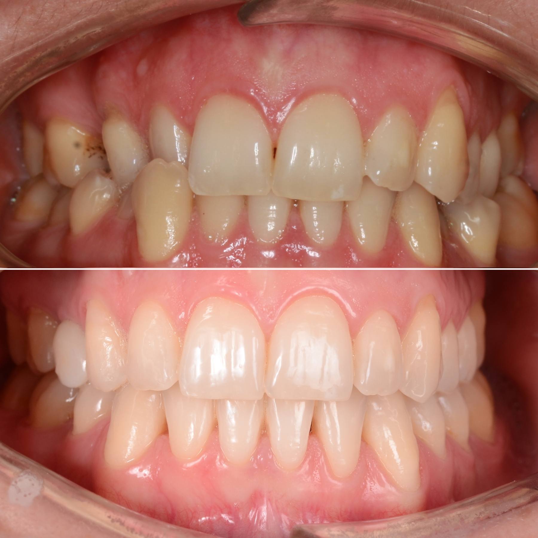 Renaissance commentator Competitive Caz clinic ortodontic complex: aparat dentar safir - Dent Complet