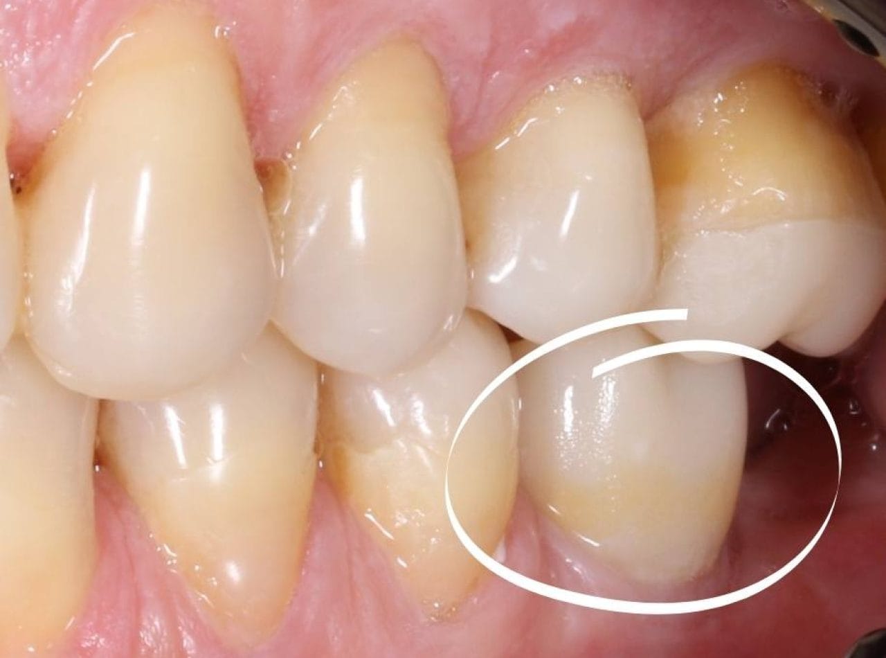 digital dentistry